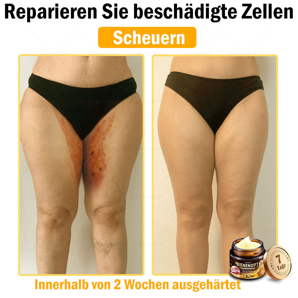 APKAPK™ Krém na regeneráciu pleti s včelím jedom 🧑⚕️Ošetrenie kožných problémov zahŕňa: vekové škvrny, jazvy, bradavice, kožné výrastky, furunkly, akné, ekzémy, psoriázu, akné inversa, vrásky, starnutie pleti a ďalšie.🔥