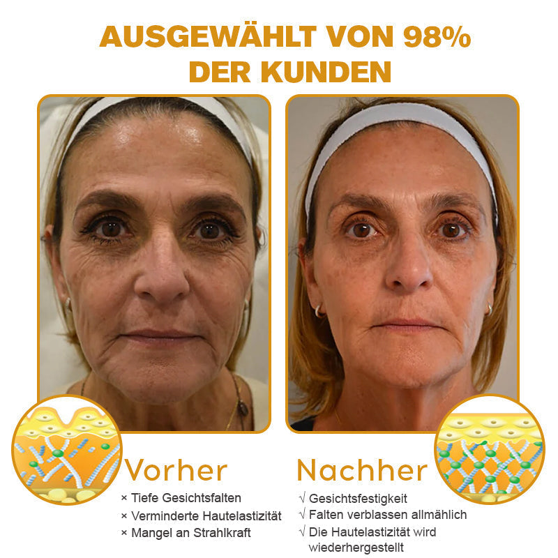 Nur 5 Flaschen! Sichern Sie sich jetzt 50% Rabatt! Verleihen Sie Ihrer Haut in 1 bis 4 Wochen jugendliche Frische. Dieses Angebot kommt erst nächstes Jahr zurück. Schnell zugreifen! 180 Tage Geld-zurück-Garantie!
