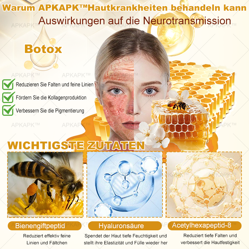 Nur 5 Flaschen! Sichern Sie sich jetzt 50% Rabatt! Verleihen Sie Ihrer Haut in 1 bis 4 Wochen jugendliche Frische. Dieses Angebot kommt erst nächstes Jahr zurück. Schnell zugreifen! 180 Tage Geld-zurück-Garantie!