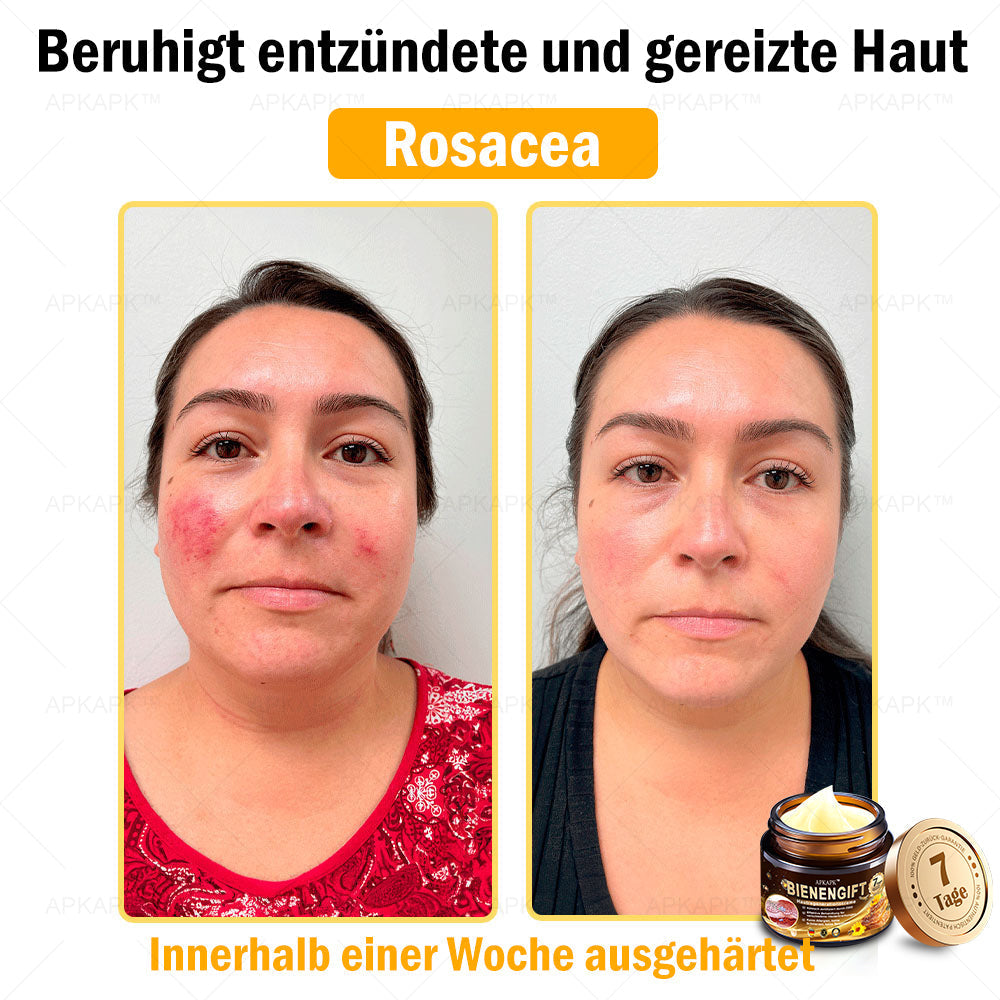 Eine letzte Chance! Schnappen Sie sich diesen GlĂŒcksfund mit 70% Rabatt!đ„180 Tage Geld-zurĂŒck-Garantie! Kostenloser Luftversand!
