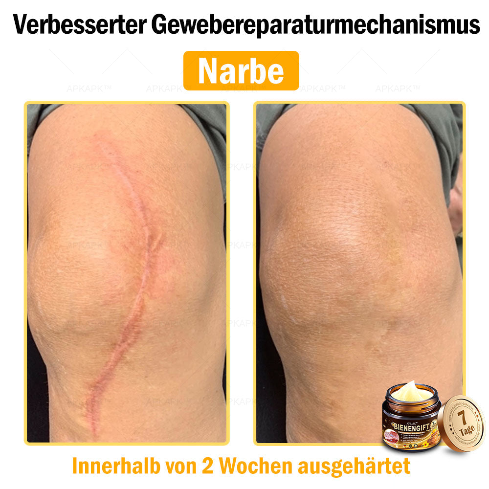 Nur 5 Flaschen! Sichern Sie sich jetzt 50% Rabatt! Verleihen Sie Ihrer Haut in 1 bis 4 Wochen jugendliche Frische. Dieses Angebot kommt erst nächstes Jahr zurück. Schnell zugreifen! 180 Tage Geld-zurück-Garantie!