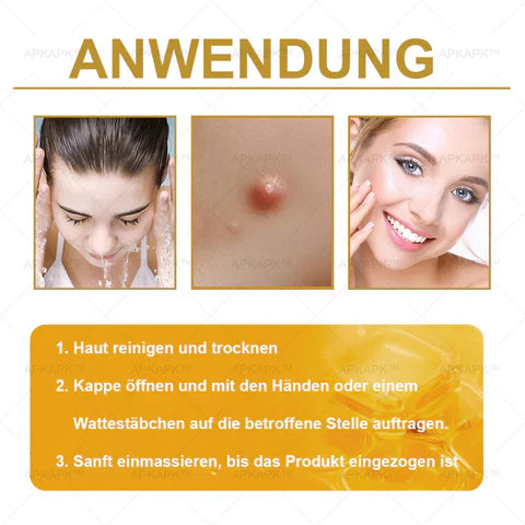 APKAPK™ Krém na regeneráciu pleti s včelím jedom 🧑⚕️Ošetrenie kožných problémov zahŕňa: vekové škvrny, jazvy, bradavice, kožné výrastky, furunkly, akné, ekzémy, psoriázu, akné inversa, vrásky, starnutie pleti a ďalšie.🔥