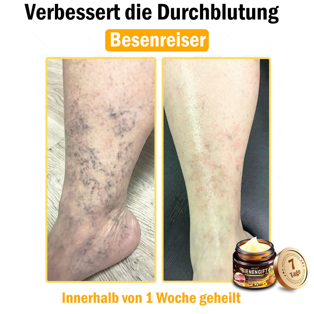 Nur 5 Flaschen! Sichern Sie sich jetzt 50% Rabatt! Verleihen Sie Ihrer Haut in 1 bis 4 Wochen jugendliche Frische. Dieses Angebot kommt erst nächstes Jahr zurück. Schnell zugreifen! 180 Tage Geld-zurück-Garantie!