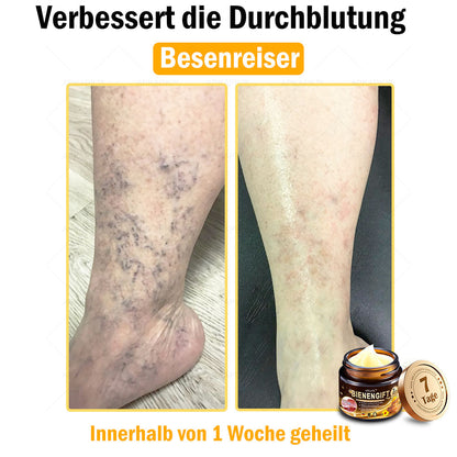 Nur 5 Flaschen! Sichern Sie sich jetzt 50% Rabatt! Verleihen Sie Ihrer Haut in 1 bis 4 Wochen jugendliche Frische. Dieses Angebot kommt erst nächstes Jahr zurück. Schnell zugreifen! 180 Tage Geld-zurück-Garantie!